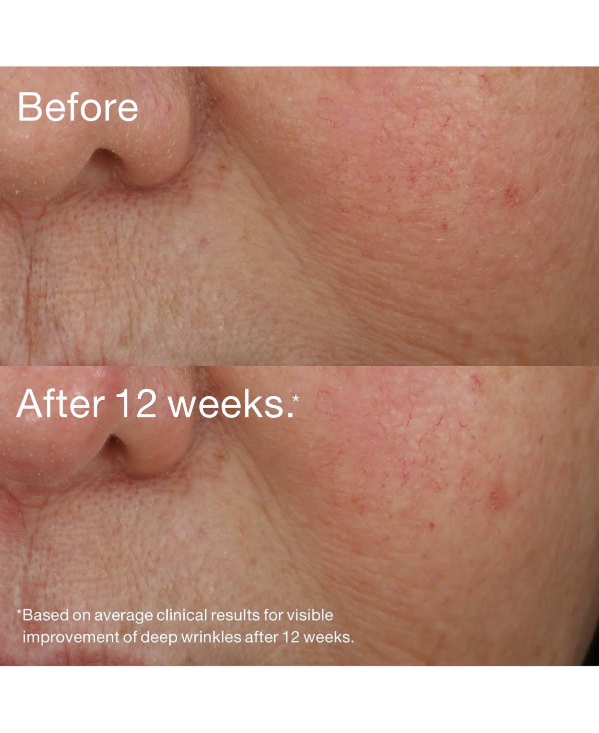 Retinol Night Repair Treatment T860